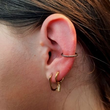 Tunnel - Expandierung von 0 auf 6 mm